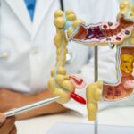 microbiota intestinale